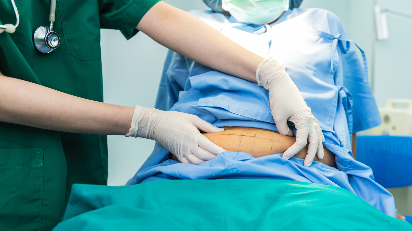 Médico operando o paciente e explicando sobre o pós-operatório da bariátrica