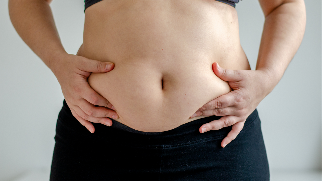 Pessoa mostrando o abdômen, para falar sobre como saber se tenho diástase